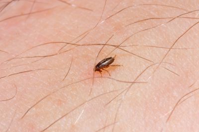 Get Effective Flea Removal!